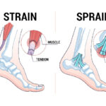 Step Away From Your Ankle & Foot Pains!